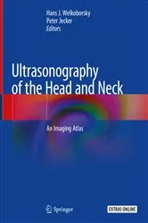 Book cover of Ultrasonography of the Head and Neck by Hans J. Welkoborsky