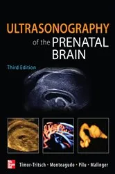 Book cover of Ultrasonography of the Prenatal Brain, Third Edition (3rd ed.) by Ilan Timor-Tritsch