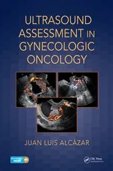 Book cover of Ultrasound Assessment in Gynecologic Oncology by Juan Luis Alcázar