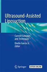 Book cover of Ultrasound-Assisted Liposuction by Onelio Garcia Jr.
