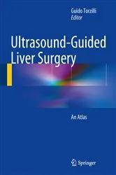 Book cover of Ultrasound-Guided Liver Surgery by Guido Torzilli