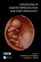 Book cover of Ultrasound in Assisted Reproduction and Early Pregnancy by Unknown