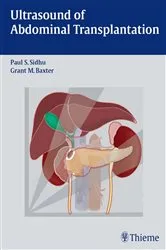 Book cover of Ultrasound of Abdominal Transplantation by Paul S. Sidhu