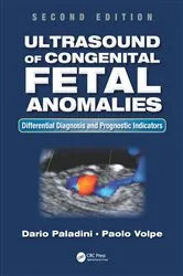 Book cover of Ultrasound of Congenital Fetal Anomalies (2nd ed.) by Dario Paladini