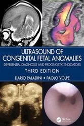 Book cover of Ultrasound of Congenital Fetal Anomalies (3rd ed.) by Dario Paladini