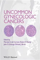 Book cover of Uncommon Gynecologic Cancers by Marcela del Carmen