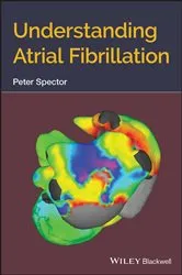 Book cover of Understanding Atrial Fibrillation by Peter Spector