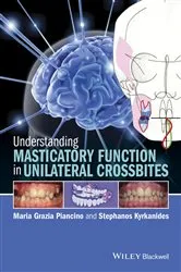 Book cover of Understanding Masticatory Function in Unilateral Crossbites by Maria Grazia Piancino