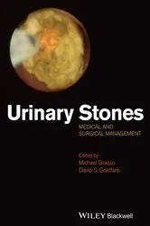 Book cover of Urinary Stones by Michael Grasso