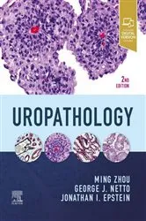 Book cover of Uropathology E-Book (2nd ed.) by Zhou MD, PhD, Ming