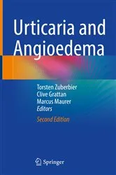 Book cover of Urticaria and Angioedema (2nd ed.) by Torsten Zuberbier