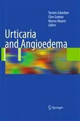 Book cover of Urticaria and Angioedema by Torsten Zuberbier