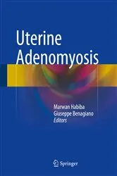 Book cover of Uterine Adenomyosis by Marwan Habiba