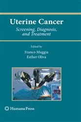 Book cover of Uterine Cancer by Franco Muggia