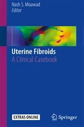 Book cover of Uterine Fibroids by Stephanie Hinderock