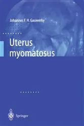 Book cover of Uterus myomatosus by Johannes F.H. Gauwerky