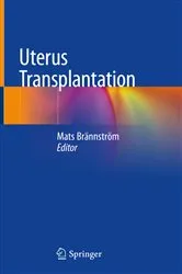 Book cover of Uterus Transplantation by Mats Brännström