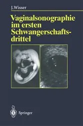 Book cover of Vaginalsonographie im ersten Schwangerschaftsdrittel by Josef Wisser