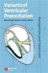 Book cover of Variants of Ventricular Preexcitation by Eduardo Back Sternick