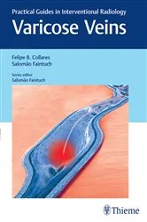 Book cover of Varicose Veins by Felipe Collares