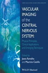 Book cover of Vascular Imaging of the Central Nervous System by Joana Ramalho