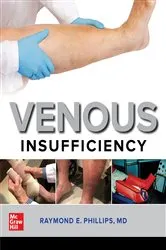 Book cover of Venous Insufficiency by Raymond E. Phillips