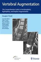 Book cover of Vertebral Augmentation by Douglas P. Beall