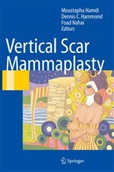 Book cover of Vertical Scar Mammaplasty by Moustapha Hamdi