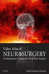 Book cover of Video Atlas of Neurosurgery E-Book by Quinones-Hinojosa MD, FAANS, FACS, Alfredo