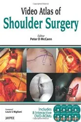 Book cover of Video Atlas of Shoulder Surgery by Peter D. McCann