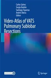 Book cover of Video-Atlas of VATS Pulmonary Sublobar Resections by Carlos Galvez