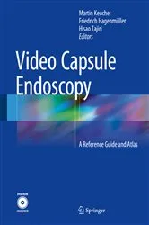 Book cover of Video Capsule Endoscopy by Martin Keuchel
