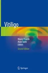 Book cover of Vitiligo (2nd ed.) by Mauro Picardo