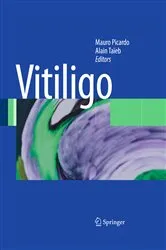 Book cover of Vitiligo by Mauro Picardo