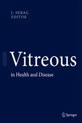 Book cover of Vitreous by J. Sebag