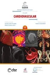 Book cover of Volume 2 - Cardiovascular by Coleção CBR - Radiologia e Diagnóstico