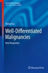 Book cover of Well-Differentiated Malignancies by Xichun Sun