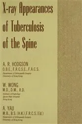 Book cover of X-Ray Appearances of Tuberculosis of the Spine by A.R. Hodgson