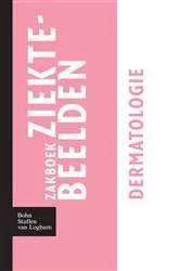 Book cover of Zakboek ziektebeelden - Dermatologie by Karin Linden