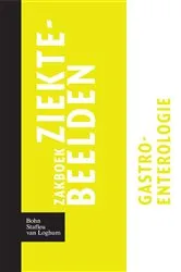 Book cover of Zakboek ziektebeelden Gastro-enterologie by Karin Linden