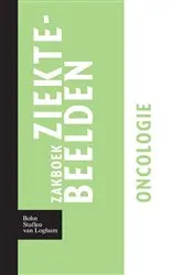 Book cover of Zakboek ziektebeelden Oncologie by Karin Linden