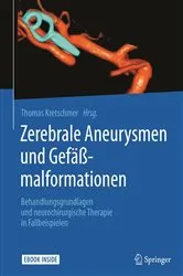 Book cover of Zerebrale Aneurysmen und Gefäßmalformationen by Thomas Kretschmer