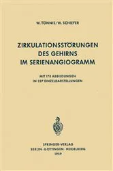 Book cover of Zirkulationsstörungen des Gehirns im Serienangiogramm by W. Tönnis