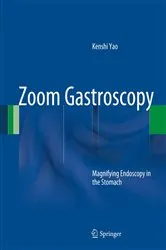 Book cover of Zoom Gastroscopy by Kenshi Yao